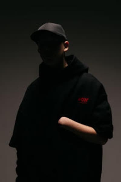 Kinderen vaker zwaargewond door vuurwerk: al tien amputaties, en ‘de piek komt nog’