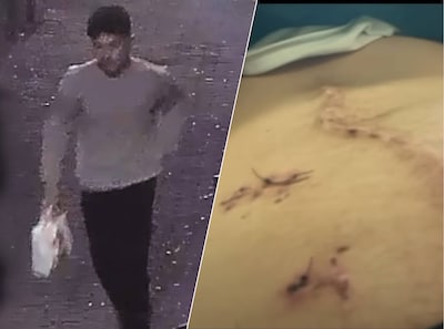Jongen filmt in ziekenhuis gruwelijk litteken na steekpartij de Dam, politie redt op nippertje z’n leven