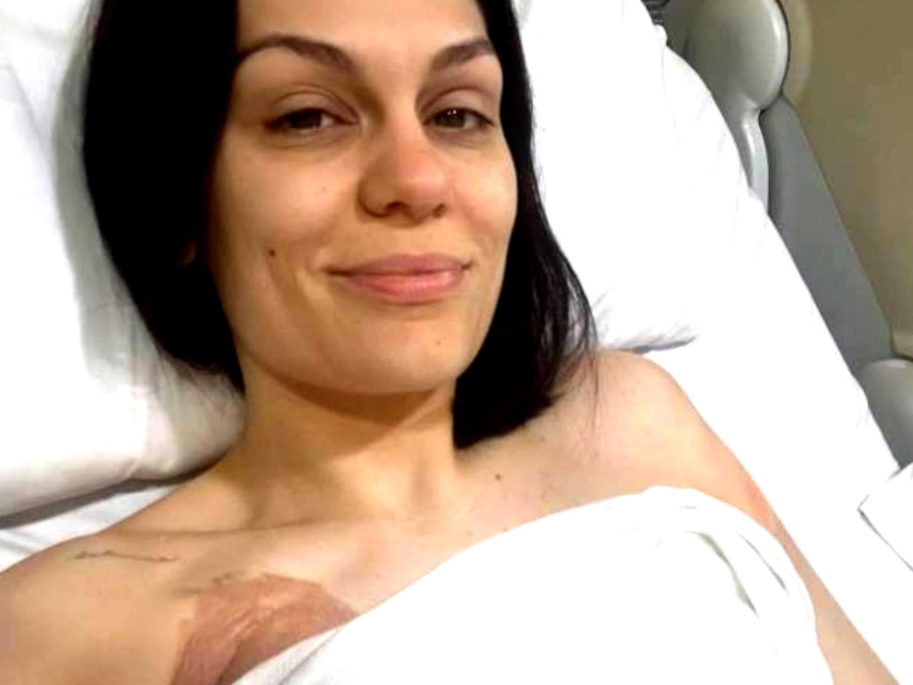 Jessie J opnieuw in het ziekenhuis na borstkankeroperatie: ‘Dit had ik niet verwacht of gepland’