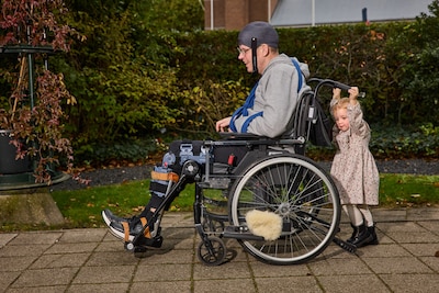 Om zijn leven te redden halen chirurgen een stuk van de schedel van Roy (34) weg: ‘Dat ligt nu in de vriezer’
