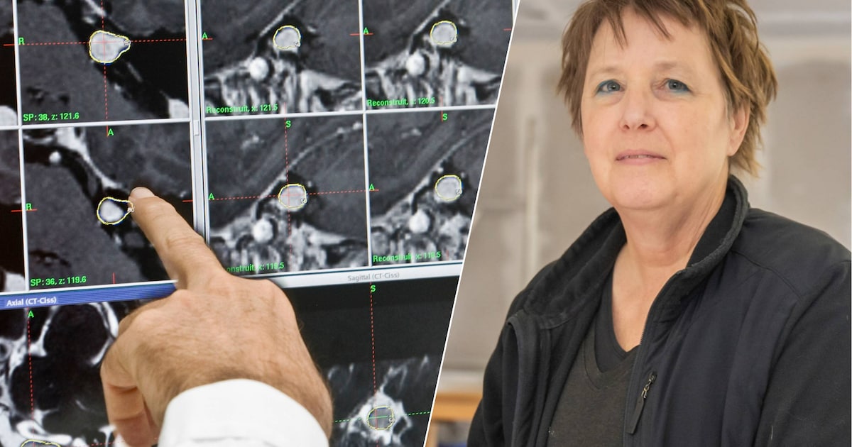 Astrid had ‘giga tumor’ in haar hoofd, maar de chirurg die haar behandelde liet expres een stukje zi