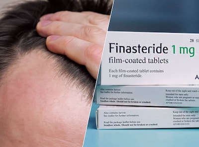 Joep zit al jaar thuis door gebruik van finasteride tegen kaalheid: ‘Zou al mijn haar inruilen voor mijn oude leven’