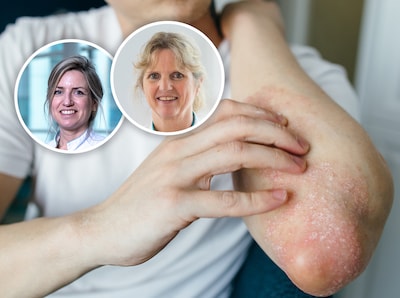 Radboudumc: patiënten met ernstige psoriasis hebben mogelijk veel minder injecties nodig