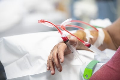 Kunnen nierpatiënten straks zonder dialyse? Onderzoek naar veelbelovende biokunstnier begint in Utre