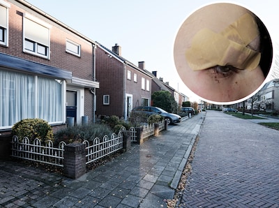 Faye (14) is geen ‘stoere meid’ meer na ongeluk in Didam: ’Die idioot scheurde zo voorbij’