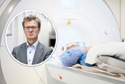 Vier op de tien kankers zijn te voorkomen, bij mannen nog vaker dan bij vrouwen