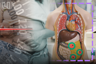 Mogelijk twee nieuwe medicijnen tegen obesitas in basispakket: ‘In combinatie met gezond leven’