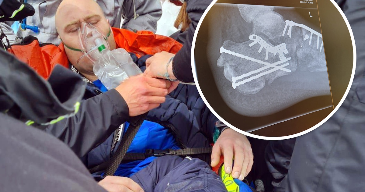 Na vijf ribbreuken, klaplong én verbrijzelde voeten staat Tim weer op de latten: ‘Mensen zeiden dat 