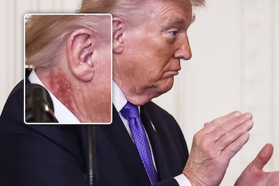 Hoe komt president Trump aan die rode plek in zijn nek? Witte Huis komt met verklaring