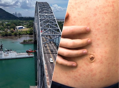 Nederlandse backpacker (21) trekt rond door Midden-Amerika en loopt mazelen op, Panama waarschuwt