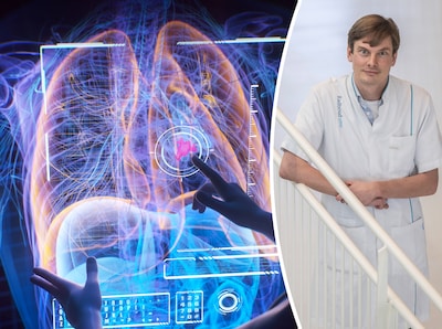 Kwart longkankerpatiënten heeft ‘zeldzame’ tumor: longarts Radboudumc legt uit wat dat betekent