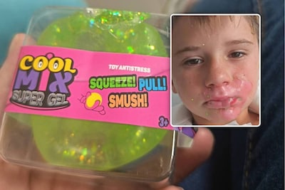 Populaire ‘squishy’ ontploft in gezicht jong kind, product blijft te koop in Nederlandse winkels Smyths Toys