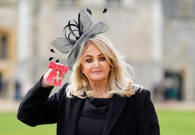Zangeres Bonnie Tyler in kunstmatige coma na spoedoperatie om herstel te bevorderen