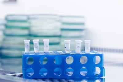 Onderzoeker (28) overleden aan pestbacterie na ongeluk in Russisch lab: honderden mensen in quarantaine