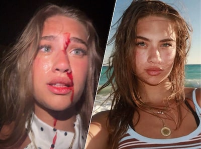 Amerikaanse influencer schakelt Nederlandse advocaat in: 'Man uit Nederland gooide glas in mijn gezicht'