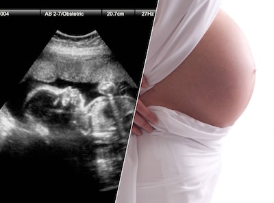 Vrouw besluit in paniek tot abortus en klaagt nu kliniek aan: ‘Ze hadden me moeten tegenhouden’