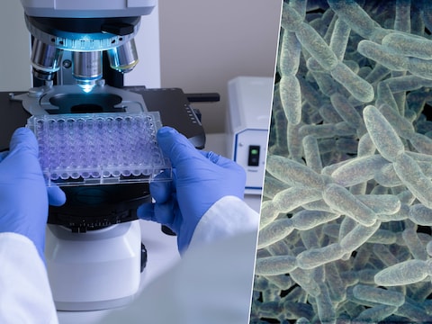 Beeld ter illustratie. Rechts: de legionellabacterie.