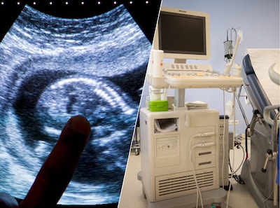 Oplossing voor ‘hiaat’: ziekenhuizen gaan late abortussen tussen 22 en 24 weken uitvoeren