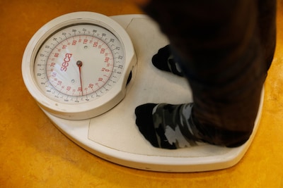 Nieuw medicijn bij obesitas na hersentumor ‘verbluffend’: vele kilo’s lichter in een jaar tijd
