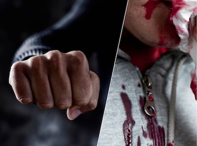 Jongen (15) komt naar huis youtuber, even later zit hij bij de spoedeisende hulp door klappen van veel oudere man: ‘Ik heb er ontzettend spijt van’