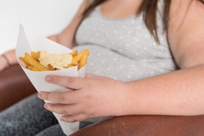 Obesitas kost samenleving toch géén 79 miljard per jaar