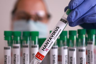 LIVE hantavirus | Minister van Volksgezondheid: Risico dat hantavirus zich in Nederland verspreidt heel klein