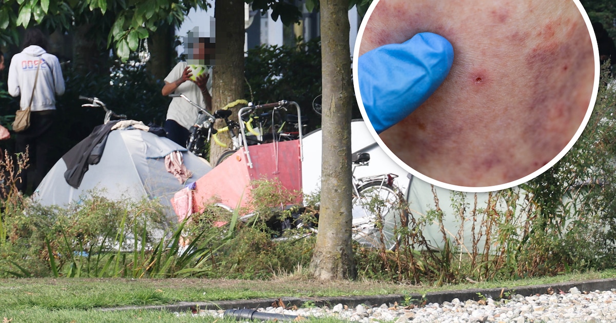 Mysterieuze rode bultjes bij daklozen op bekend verkeersplein in ...